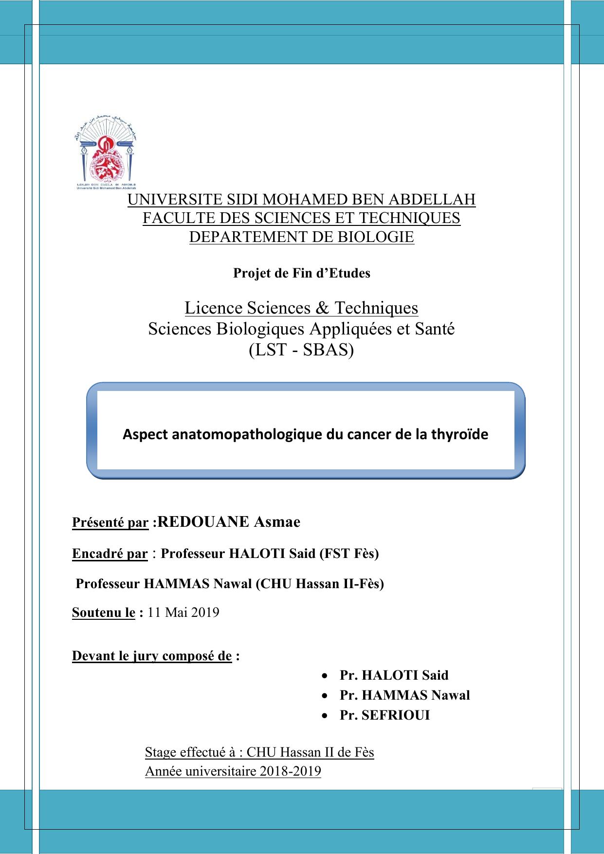 Aspect anatomopathologique du cancer de la thyroïde